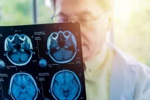 Doctor holding a brain scan