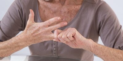 Older woman with arthritis stretching her finger